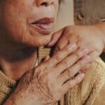 Symptoms of vascular dementia